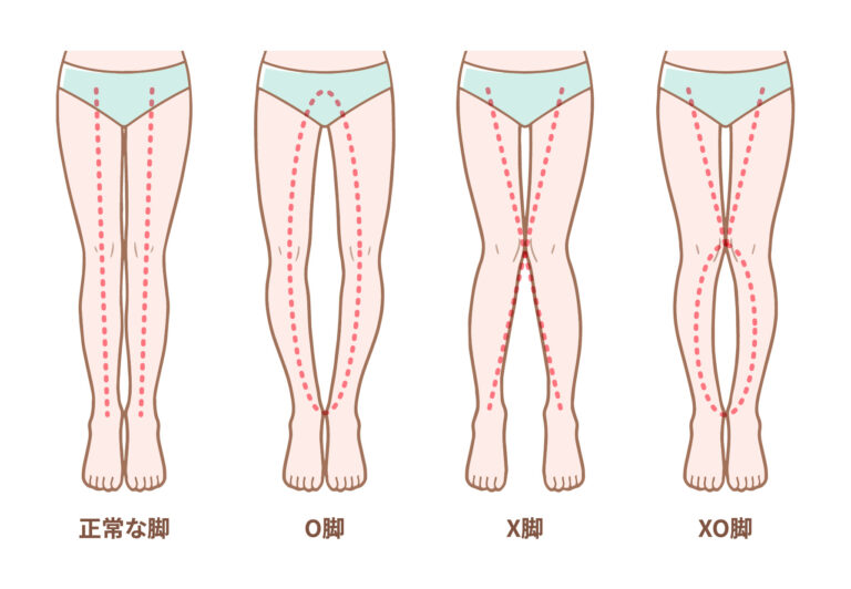 夏に向けて体のラインを綺麗に！！　下半身編　2