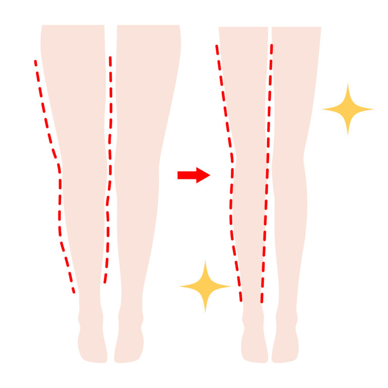 脚のラインを改善して下半身美人に☆　２