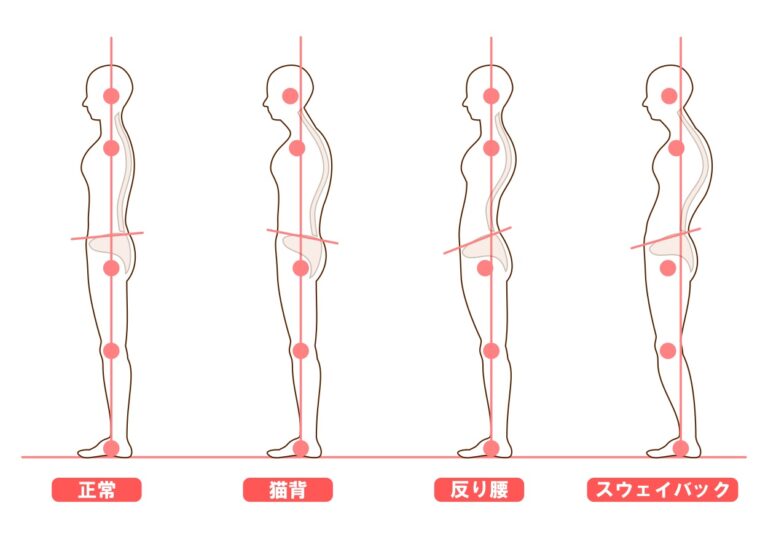 【スウェイバック姿勢】猫背の方必見！！