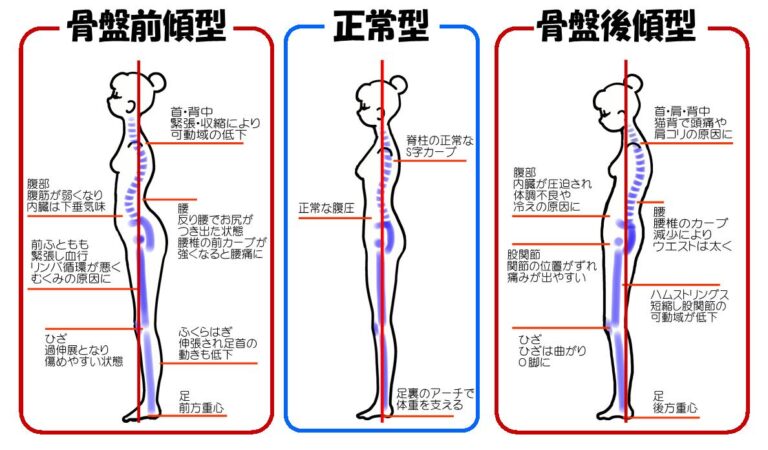 【肋骨の開きと反り腰】の関係性