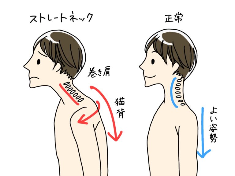 【巻き肩】になるとこんなデメリットが！