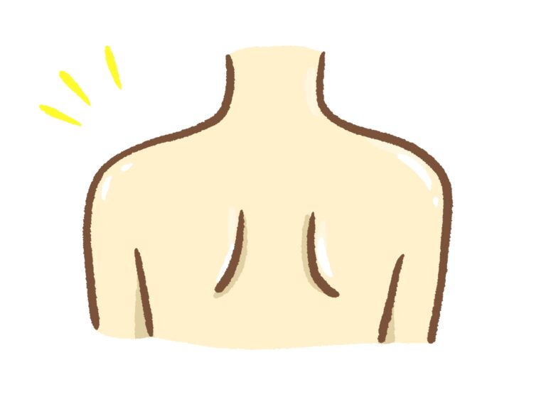 【天使の羽に】でも本当に大丈夫？【翼状肩甲】　４